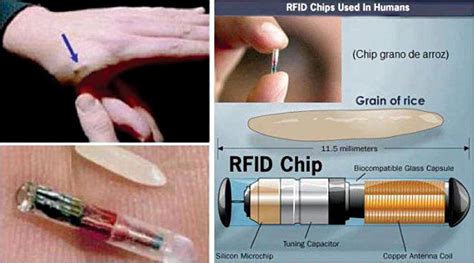 rfid chip luigi|A Brave New World: Use of Biometric Identifiers and RFID Chips .